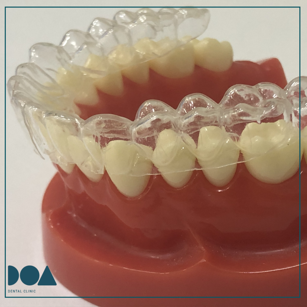 Retenedor ortodoncia removible transparente
