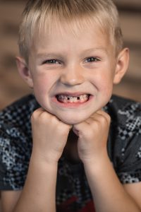 endodoncia en niños