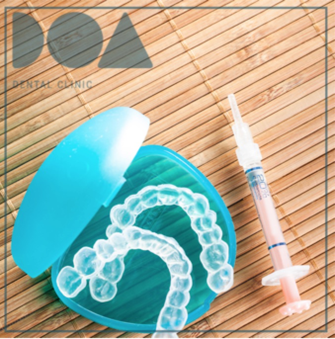 blanqueamiento dental externo