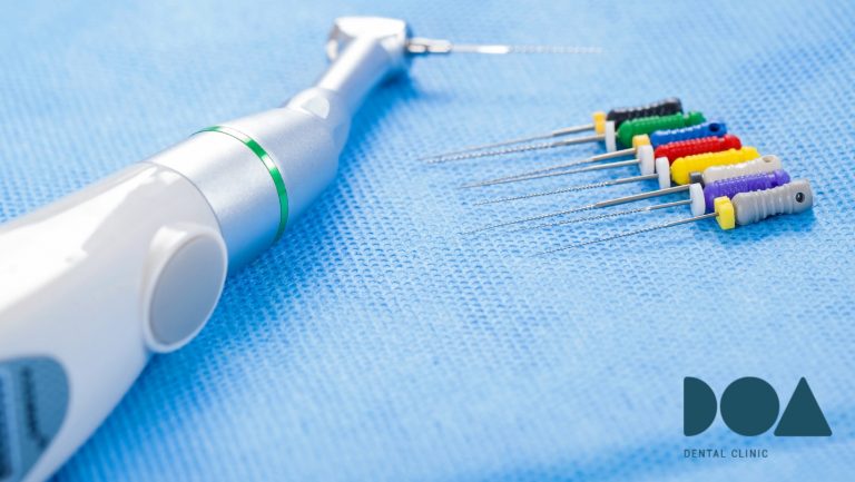 que es una endodoncia
