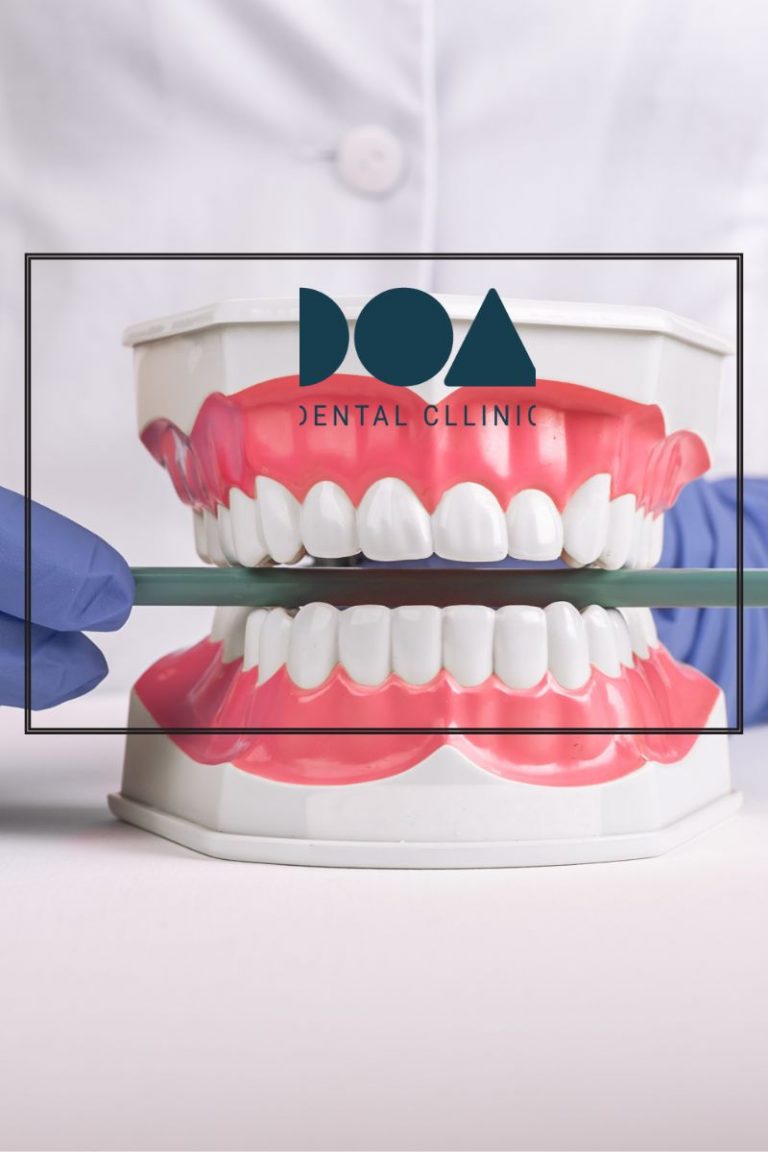 importante dientes alineados