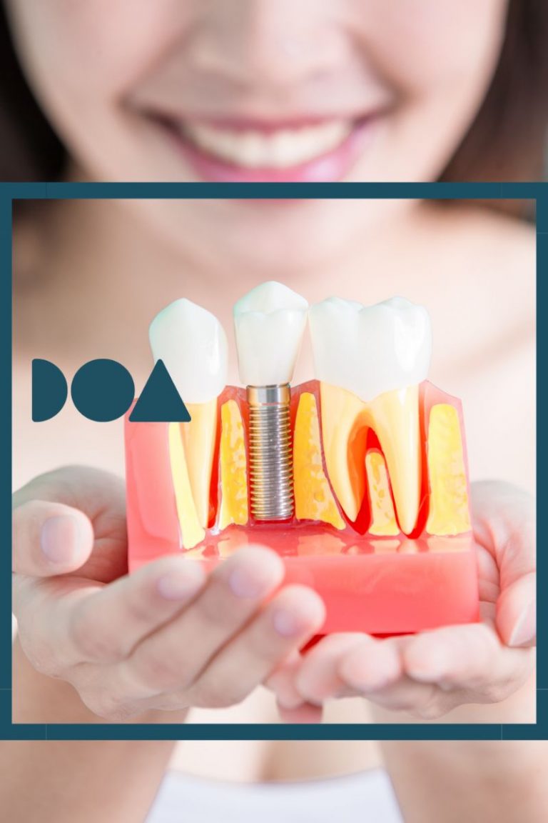 cuidado implante dental
