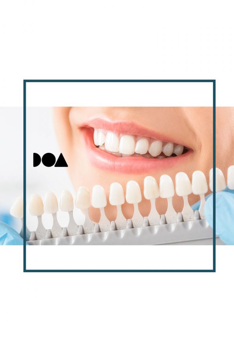 color de los dientes
